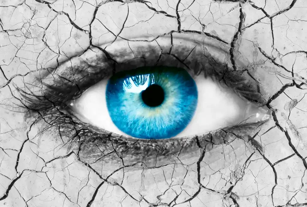 Why Are My Eyes So Dry?