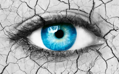 Why Are My Eyes So Dry?